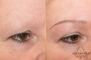 microbladingeyebrow_8